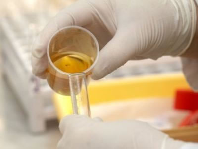 exame toxicologico de urina em curitiba drogas